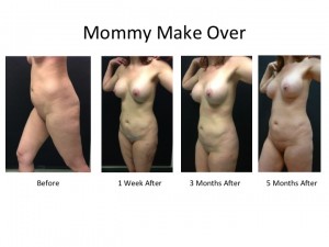 Slide2