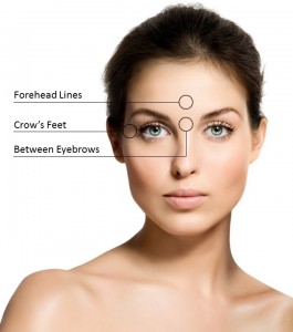 Different Botox Areas