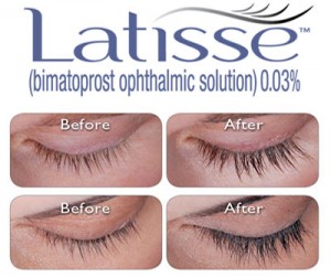 Treatment for Inadequate Eyelashes