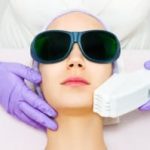 Laser hair removal candidates
