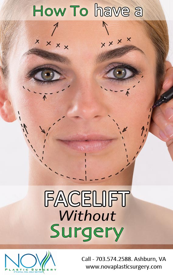 Face lift without surgery