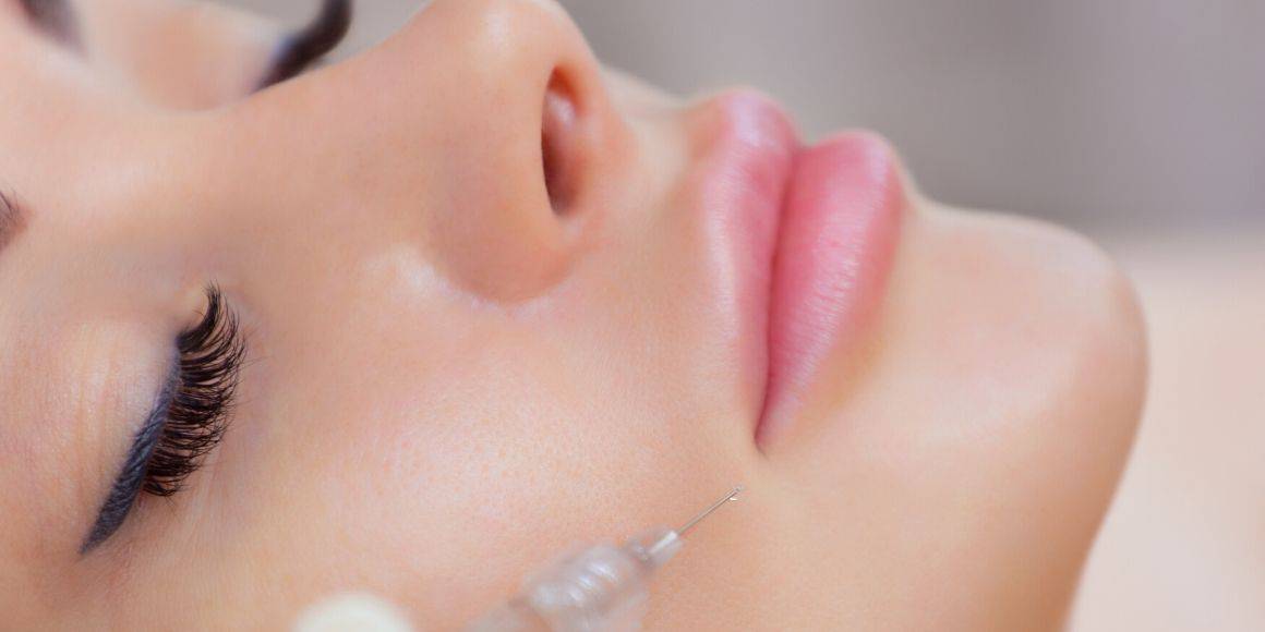 When Should You Consider Dermal Fillers