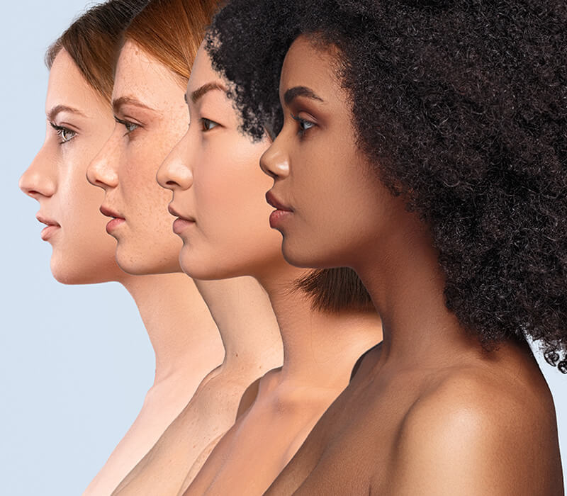 Women with different skin tones