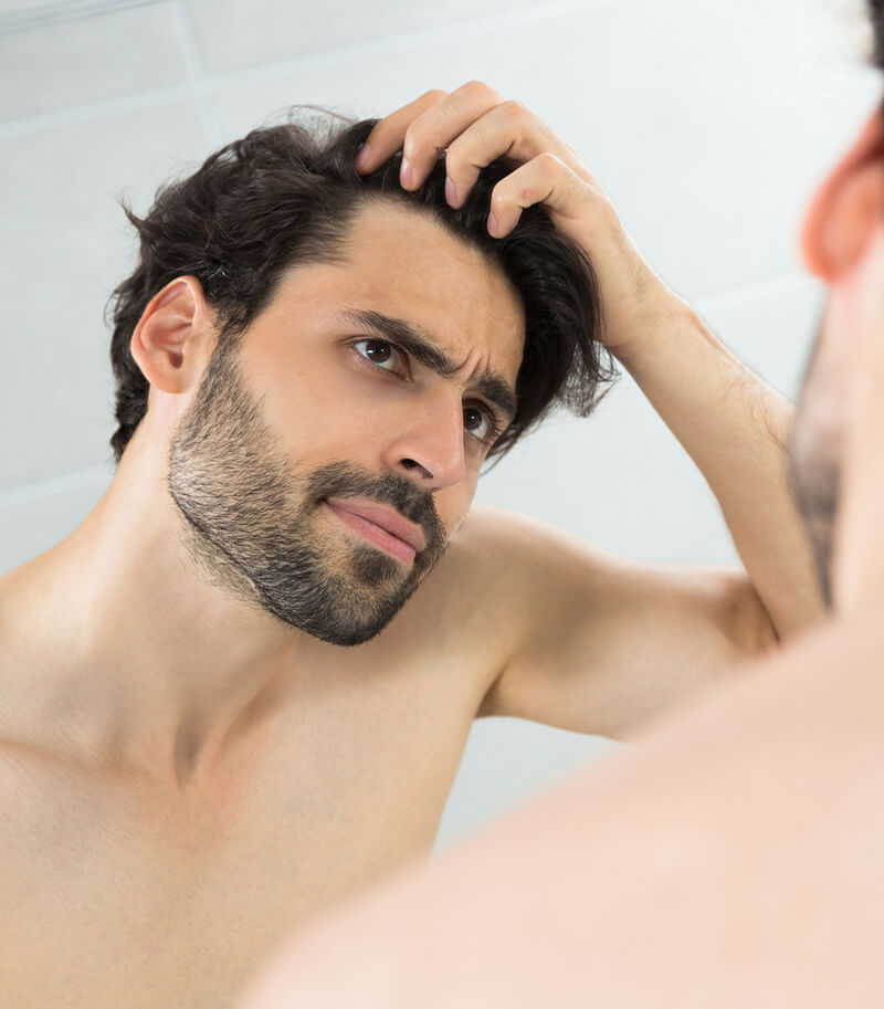Man experiencing hair loss