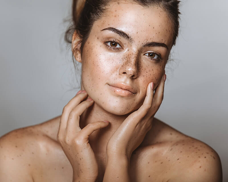 Beautiful woman with freckles