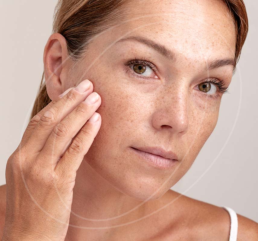 Middle aged woman with freckles