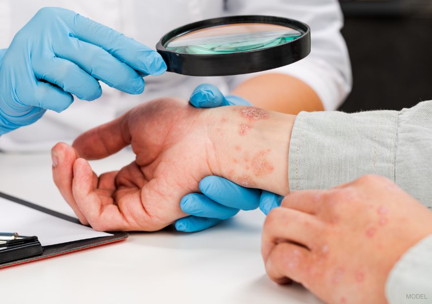 medical professional looking at a man's skin condition using a manifier