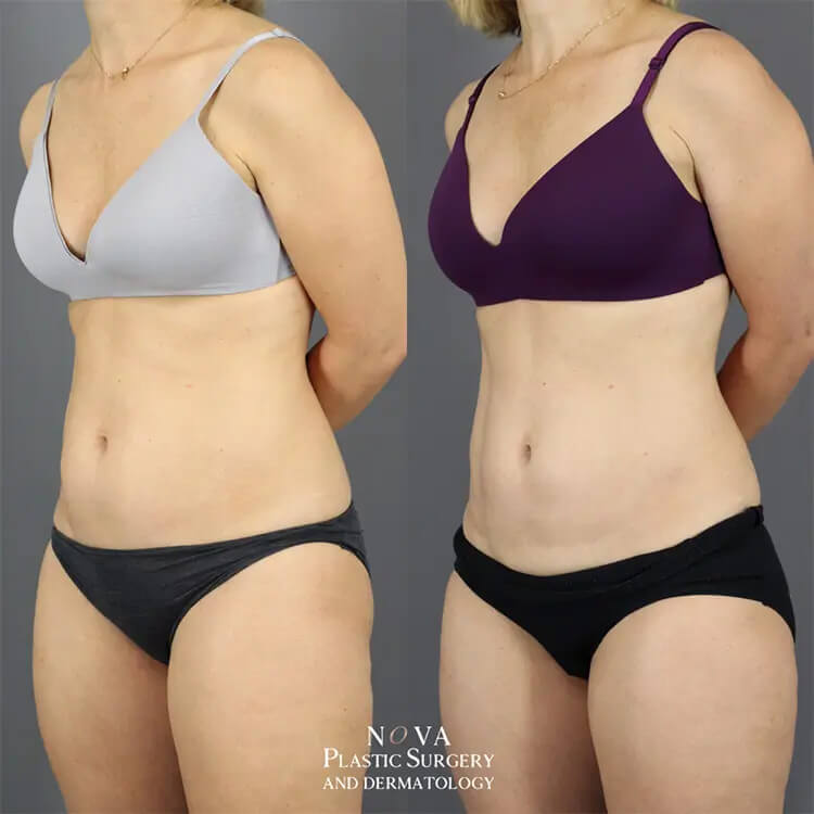 Actual Patient Results