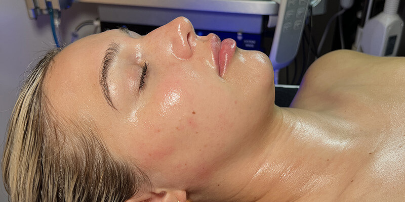 Woman with glowing skin